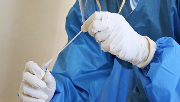 doctor in gloves holding a test kit